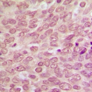 CPA2188-100ul - TP53 / p53