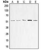 CPA2188-100ul - TP53 / p53