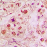 CPA2189-100ul - TP53 / p53