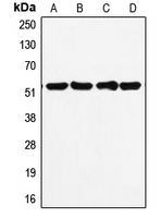 CPA2189-100ul - TP53 / p53