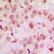 CPA2190-100ul - TP53 / p53
