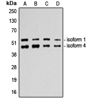 CPA2190-100ul - TP53 / p53