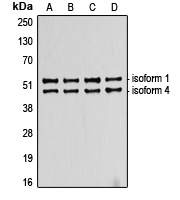 CPA2191-100ul - TP53 / p53