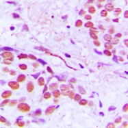 CPA2197-100ul - TUBG1 / Tubulin gamma 1