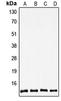 CPA2199-100ul - Thioredoxin / TRX1