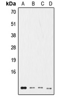 CPA2201-100ul - Ub