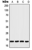 CPA2205-100ul - UBC9 / UBE2I
