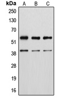 CPA2227-100ul - Vimentin