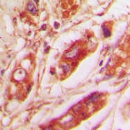 CPA2228-100ul - Vimentin
