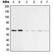 CPA2228-100ul - Vimentin