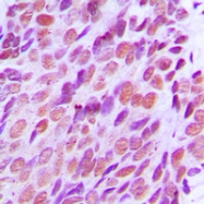 CPA2235-100ul - XRCC2