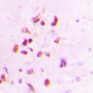 CPA2236-100ul - XRCC3