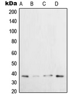 CPA2236-100ul - XRCC3