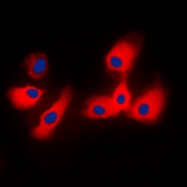 CPA2241-100ul - 14-3-3 protein epsilon