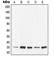 CPA2241-100ul - 14-3-3 protein epsilon
