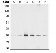 CPA2243-100ul - 14-3-3 protein zeta/delta