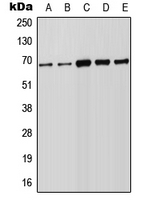CPA2280-100ul - FOXN1