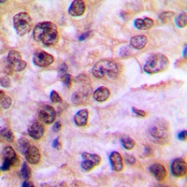 CPA2290-100ul - NEMO / IKBKG