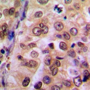 CPA2291-100ul - NEMO / IKBKG
