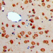 CPA2318-100ul - CD256 / APRIL