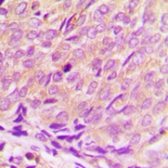 CPA2330-100ul - HDAC3