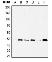 CPA2330-100ul - HDAC3