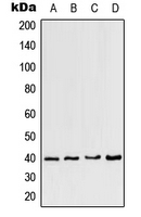 CPA2343-100ul - CCRL2 / CCR11