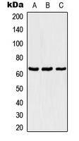 CPA2352-100ul - TBX18