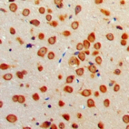 CPA2389-100ul - Netrin-1