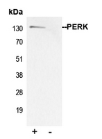CPA2394-100ul - EIF2AK3
