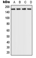 CPA2396-100ul - ROCK2