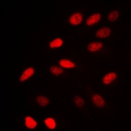 CPA2409-100ul - NCOR1