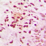 CPA2409-100ul - NCOR1