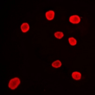 CPA2419-100ul - HDAC9