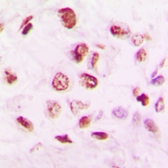 CPA2419-100ul - HDAC9