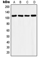 CPA2419-100ul - HDAC9