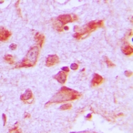 CPA2430-100ul - PJA2 / RNF131