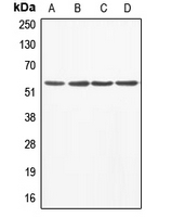 CPA2442-100ul - ABI1 / SSH3BP1