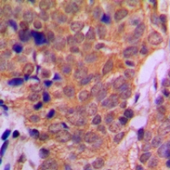 CPA2443-100ul - HDAC6