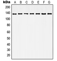 CPA2443-100ul - HDAC6