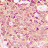 CPA2444-100ul - HDAC5