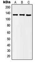 CPA2444-100ul - HDAC5