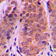 CPA2445-100ul - HDAC5