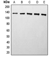 CPA2445-100ul - HDAC5