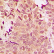 CPA2446-100ul - HDAC5