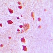 CPA2520-100ul - Peroxiredoxin-3 / PRDX3