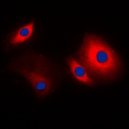 CPA2548-100ul - Cortactin