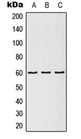 CPA2557-100ul - CCT5 / TCP1 epsilon