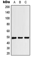 CPA2560-100ul - RBM34