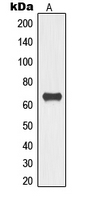 CPA2609-100ul - TOR1AIP1
